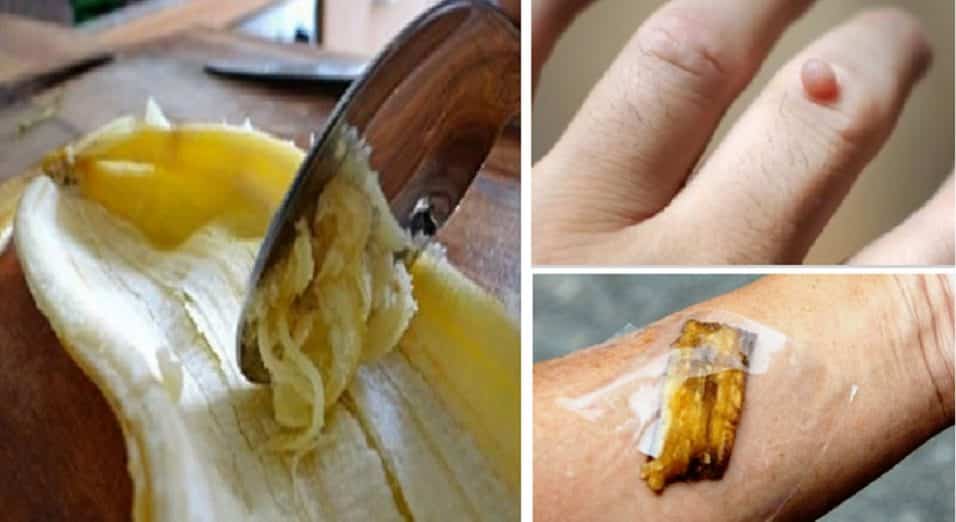 Buccia di banana per il viso e sulla pelle