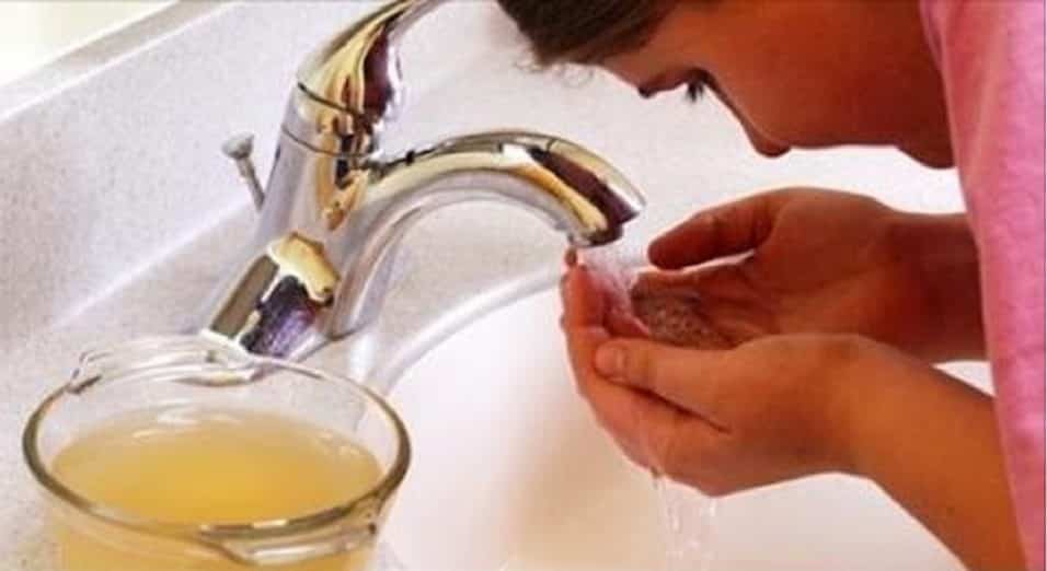 Aceto di mele per il viso e sulla pelle