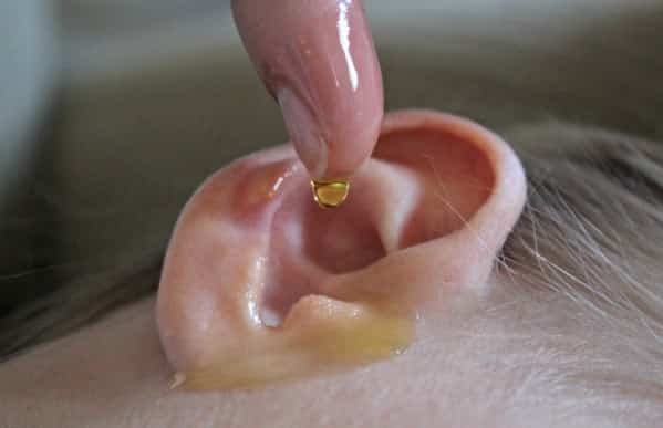 otite e mal d'orecchio potenti ed efficaci rimedi naturali