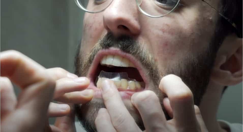Kit sbianca denti in farmacia - strisce sbiancanti