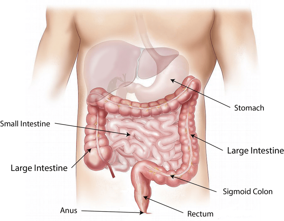Tumore al colon retto e intestino