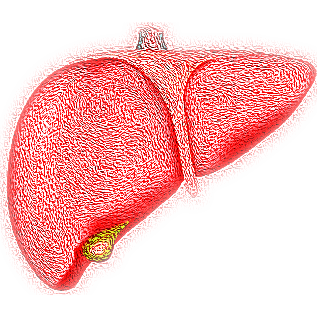 Intossicazione del fegato